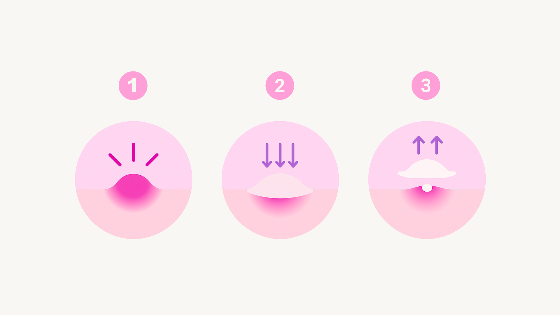 a 3 step diagram showing how a microneedle spot patch works