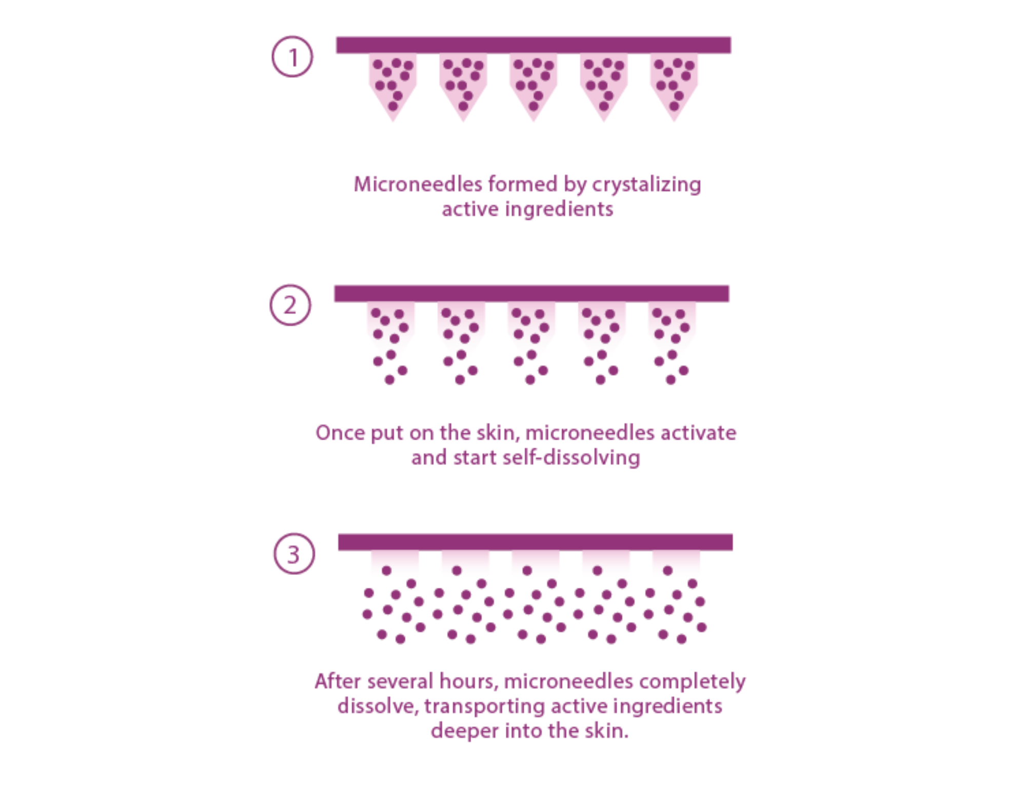 a 3 step diagram showing how a microneedle spot patch works